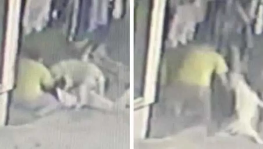 16 yaşındaki çocuğa pitbulllar saldırdı 46 dikiş atıldı