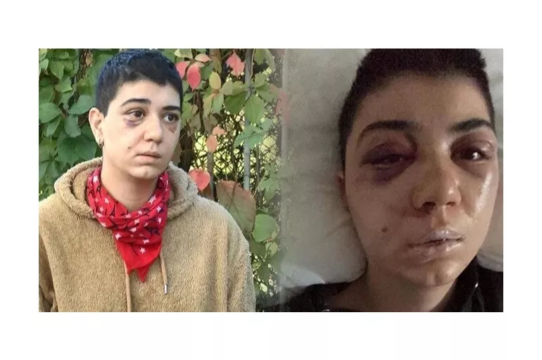 Beyoğlu'nda kadına canice saldırı! Felç geçirdi