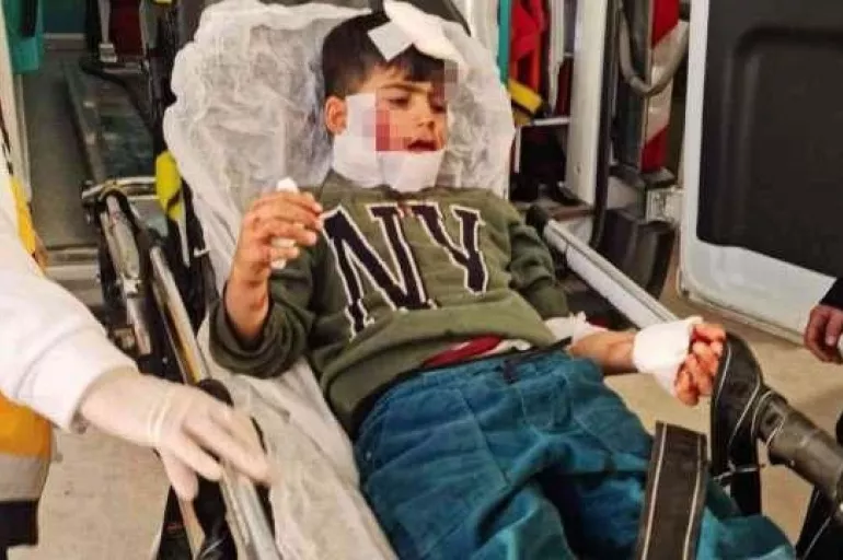 Mardin'de sokak köpeği dehşeti! 7 yaşındaki Ahmet'in hayati tehlikesi sürüyor