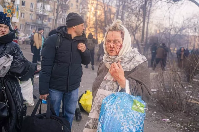 Ukrayna'da milyonlarca insan evinden oldu! İşte savaşın acı bilançosu