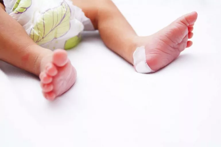 Bebeklerde neden topuktan kan alınır? Risk taşıyan hastalıklar topuk kanı ile erken teşhis edilebiliyor!