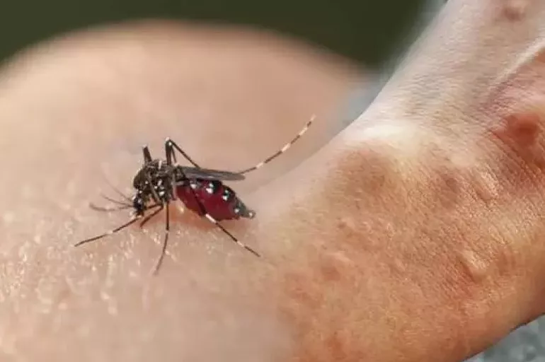 Aedes sivrisineği nasıl görünüyor? Aedes sivrisinek ısırığı belirtileri nedir?