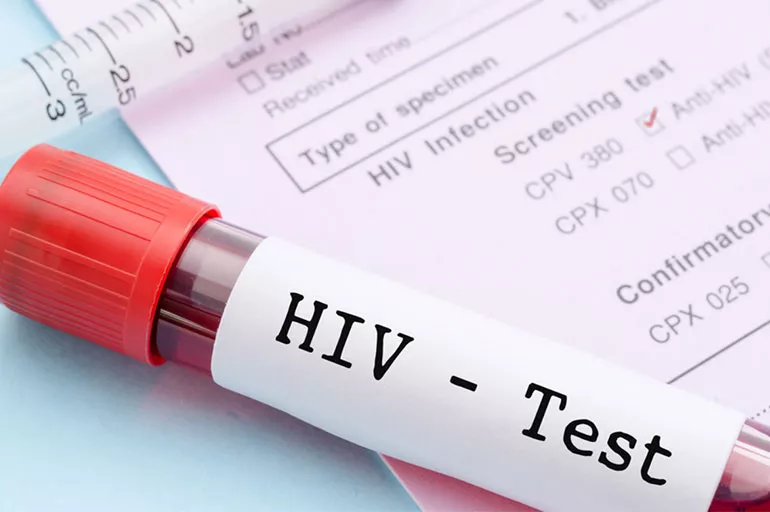 HIV virüsü - AIDS nedir? HIV nasıl bulaşır, belirtileri neler? HIV tedavisi var mı?