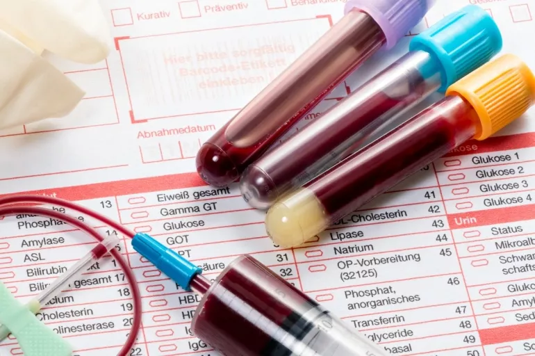 Hangi kan tahlilleri açken yapılır? Su içmek test sonucunu etkiler mi?