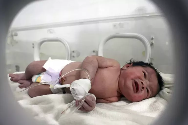 Enkaz altında dünyaya gelmişti: Suriyeli bebeği binlerce kişi evlat edinmek istedi! İşte yeni ailesi