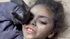 İsrail saldırısında enkaz altında kalan kız çocuğu seslendi: Ailemi istiyorum