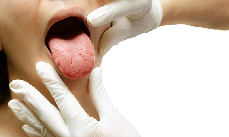 Doktorlar uyarıyor: Diliniz bu renkteyse hemen hastaneye gidin!
