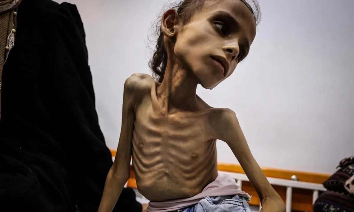 25 kilodan 10 kiloya düştü: Gazzeli küçük Meryem günden güne eriyor!