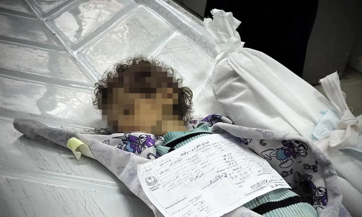 Artık yeter! Gazze'de bir çocuk daha açlıktan öldü