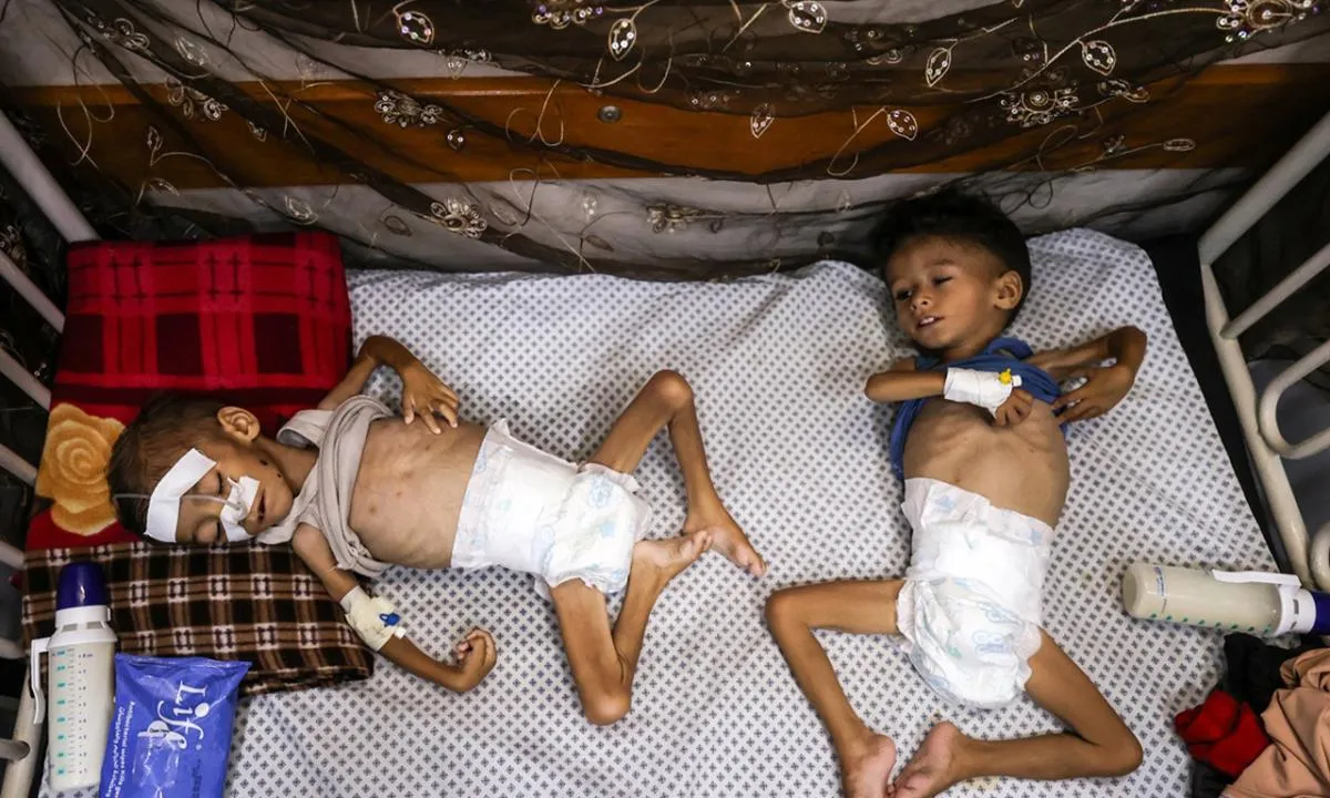 Soykırım saldırıları durmak bilmiyor! Gazze Şeridi'nde açlık sürüyor: 24 saate 4 kişi hayatını kaybetti!  