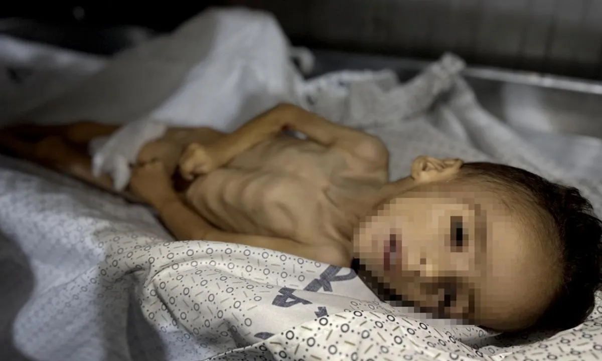 Bir yavru daha şehit! İsrail'in aç bıraktığı 5 yaşındaki engelli Muhammed'in bedeni daha fazla dayanamadı