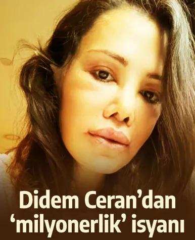Yüz naklinden 21 gün sonra paylaştı! Didem Ceran: Canımdan bezdim!